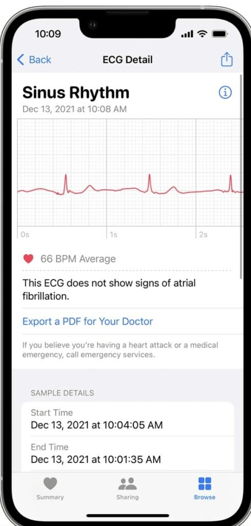 apple watch ecg app